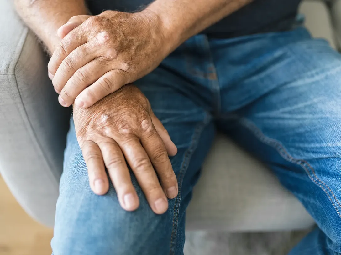 Older man resting his hands on his knee